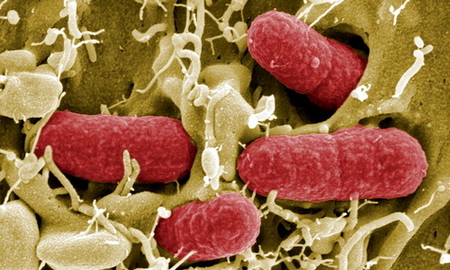 Bakterije mogu izazvati neplodnost